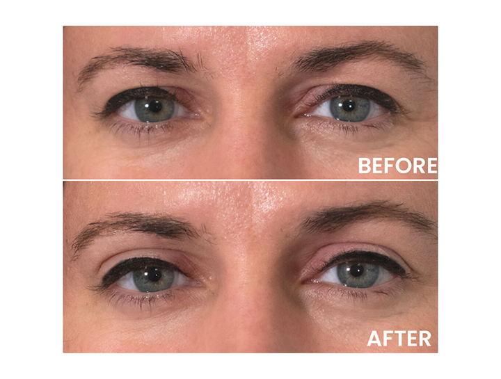 Achieve Dramatic Youthful Results