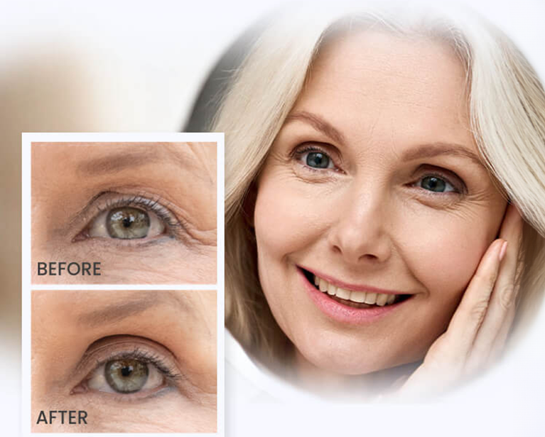 <font color="#232323"><b>Lift and Enhance Your<br>Eyes in Seconds! Look 10<br>Years Younger Tonight</b></font>